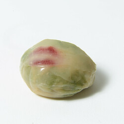 Tumeur (Tumor)
